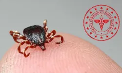 Sağlık Bakanlığı’ndan Kene Açıklaması