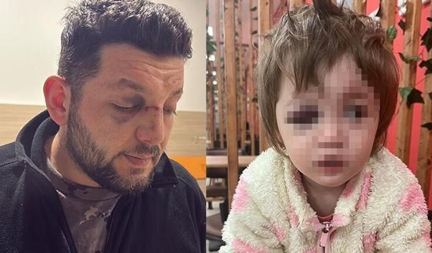 Yalova’da Komşu Kavgası Kanlı Bitti: Baba ve 14 Aylık Bebeğe Sopayla Saldırı