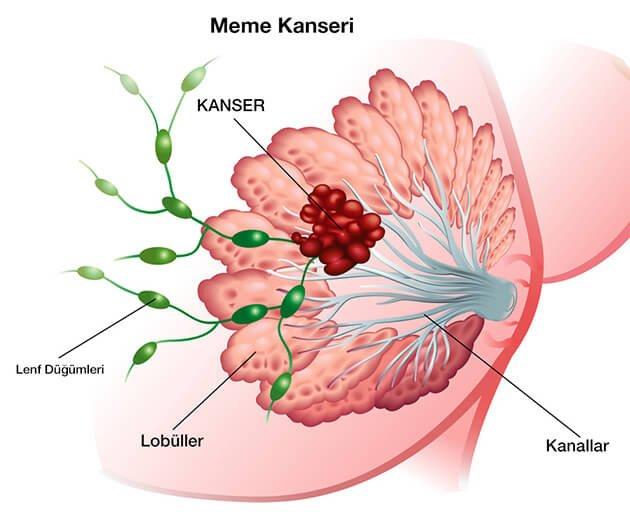 Kanserde erkenteşhis